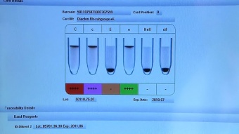 IH-1000 Автоматический анализатор для иммуногематологических исследований