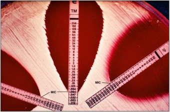 Тесты для определения чувствительности к антибиотикам Etest